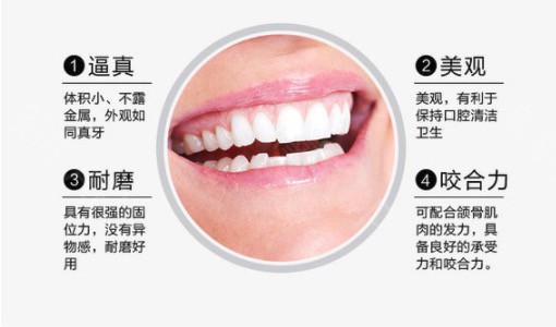 韓國(guó)登騰Dentium種植體