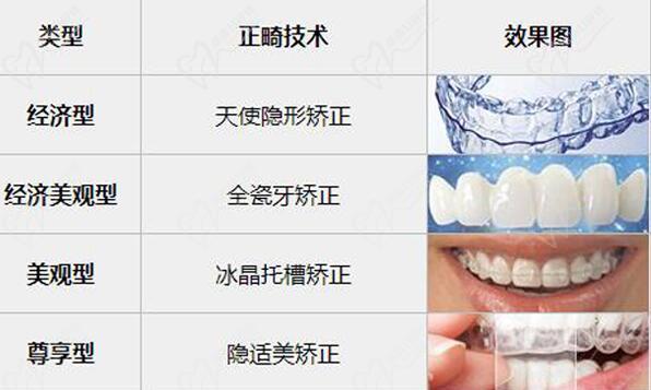 成都極光口腔矯正牙齒怎么樣？