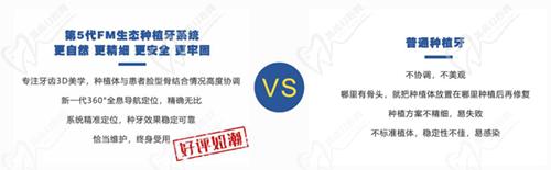 北京鈦植口腔種植