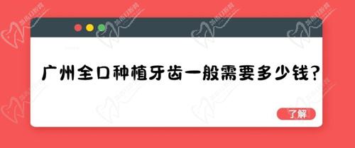 廣州全口種植牙齒一般需要多少錢？