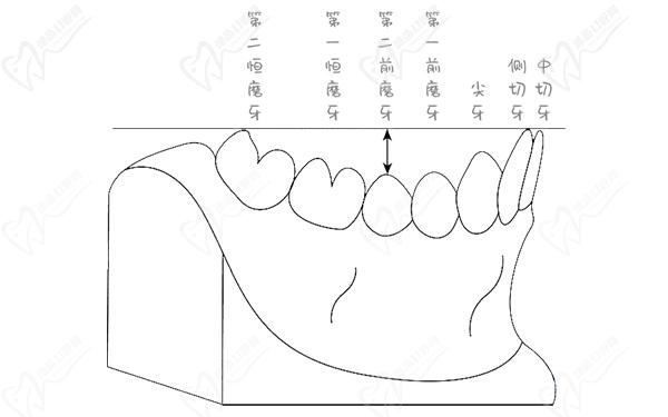 正畸spee曲線的測(cè)量圖