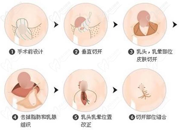 2024北京聯(lián)合麗格醫(yī)院微整注射收費標(biāo)準(zhǔn)