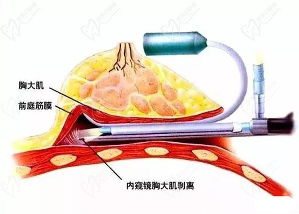 南京做胸部整形醫(yī)院醫(yī)生排名榜