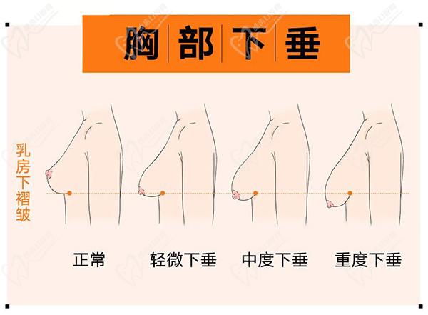 南京做胸部整形醫(yī)院醫(yī)生排名榜