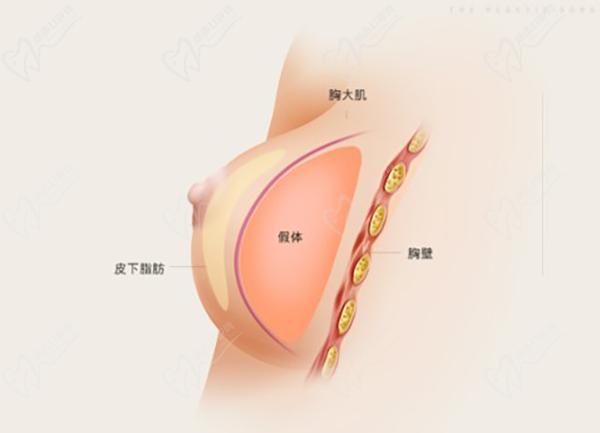 南京做胸部整形醫(yī)院醫(yī)生排名榜