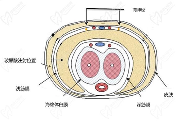 男性生殖整形手術(shù)費(fèi)用大概需要多少錢(qián)