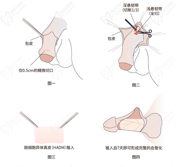 李世榮醫(yī)生做男科手術怎么樣