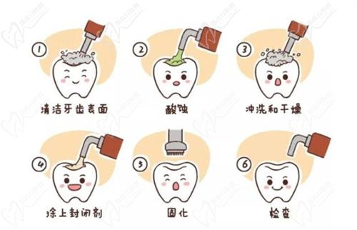 嵌體補(bǔ)牙能用一輩子嗎