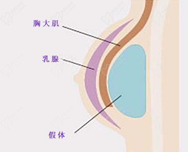 隆胸預約網(wǎng)上報名