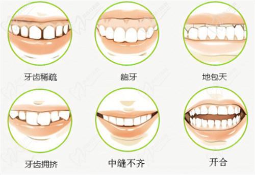 可麗兒隱形矯正多少錢一副2025？