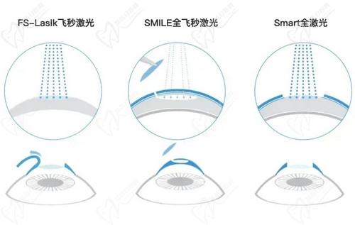 石家莊愛眼眼科魏玲醫(yī)生技術(shù)扎實