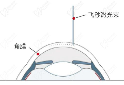 石家莊愛眼眼科魏玲醫(yī)生技術(shù)扎實