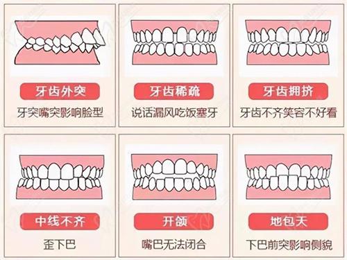 侯憲昂醫(yī)生正畸怎么樣