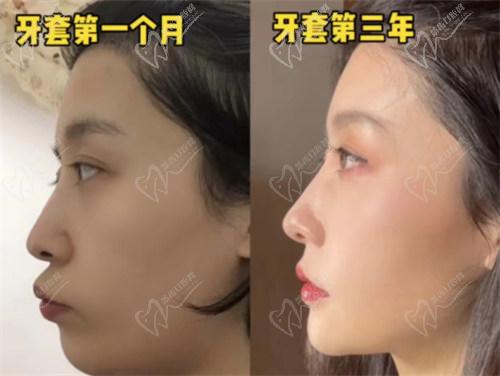 四、如何預(yù)約拜博口腔醫(yī)院牙齒矯正？