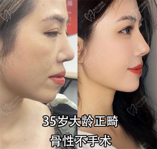 拜博口腔整牙多少錢