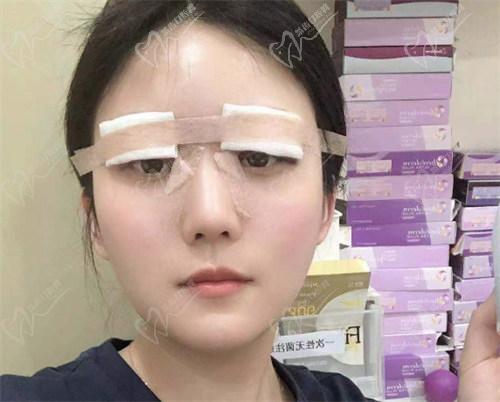 手術當天的情況：過程和感受
