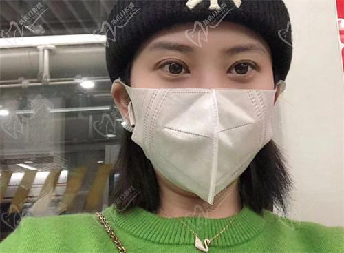 術后5個月的恢附情況：穩(wěn)定期和寬度微調(diào)