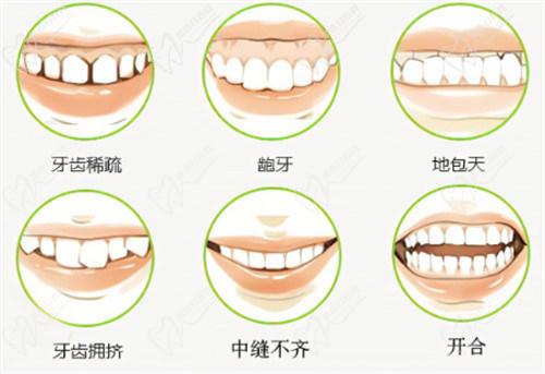 2025年國內(nèi)牙齒矯正價(jià)格因矯正方式、醫(yī)院級(jí)別和地區(qū)差異而有所不同