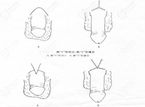 李世榮延長(zhǎng)手術(shù)的高定價(jià)，本質(zhì)上是醫(yī)療價(jià)值的真實(shí)體現(xiàn)