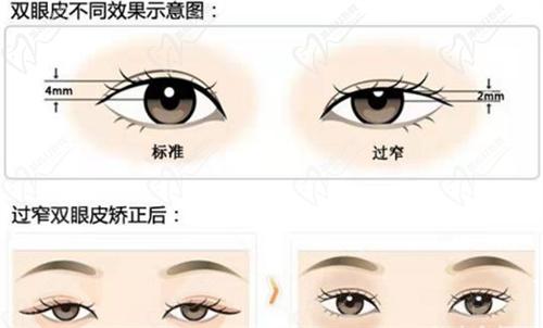 六、北京豐聯(lián)麗格整形醫(yī)院師麗麗醫(yī)生雙眼皮手術(shù)預(yù)約掛號(hào)方式