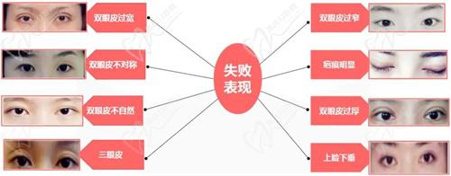 七、術(shù)前準(zhǔn)備與注意事項(xiàng)