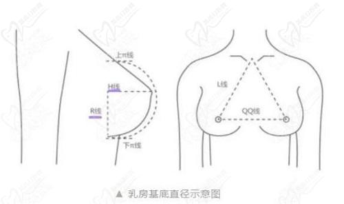 劉正茂與曹勇醫(yī)生技術(shù)對(duì)比分析