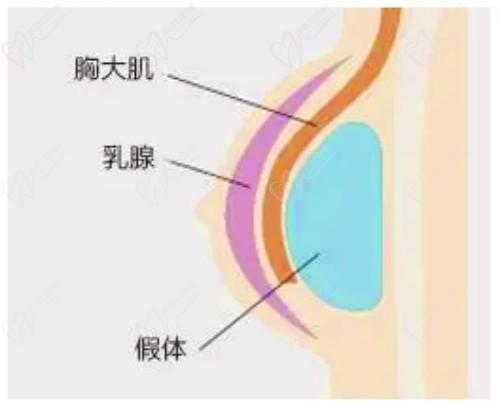 米蘭柏羽開(kāi)啟胸部醫(yī)生面診日，穆大力、李英大親診做出精致自然美胸