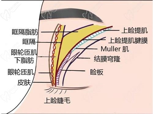 師麗麗雙眼皮修復(fù)成功率大嗎？看了好多真人修復(fù)實(shí)例和口碑評(píng)價(jià)無(wú)黑料