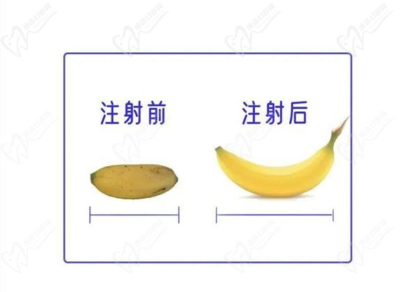 李世榮做一次延長手術(shù)多少錢？2025年李世榮男科價格表延長手術(shù)4.5w+假體植入3w+注射增粗5萬起
