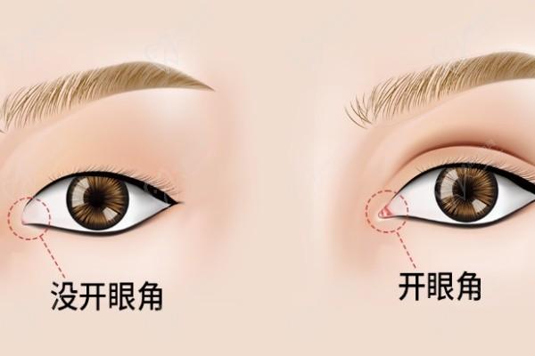 王衡健雙眼皮是雜牌子嗎知乎澄清不是-是九院正規(guī)雙眼皮高檔次修復醫(yī)生